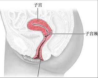 宫颈手术部位示意图