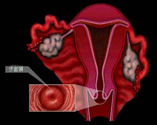 宫颈及其位置示意图